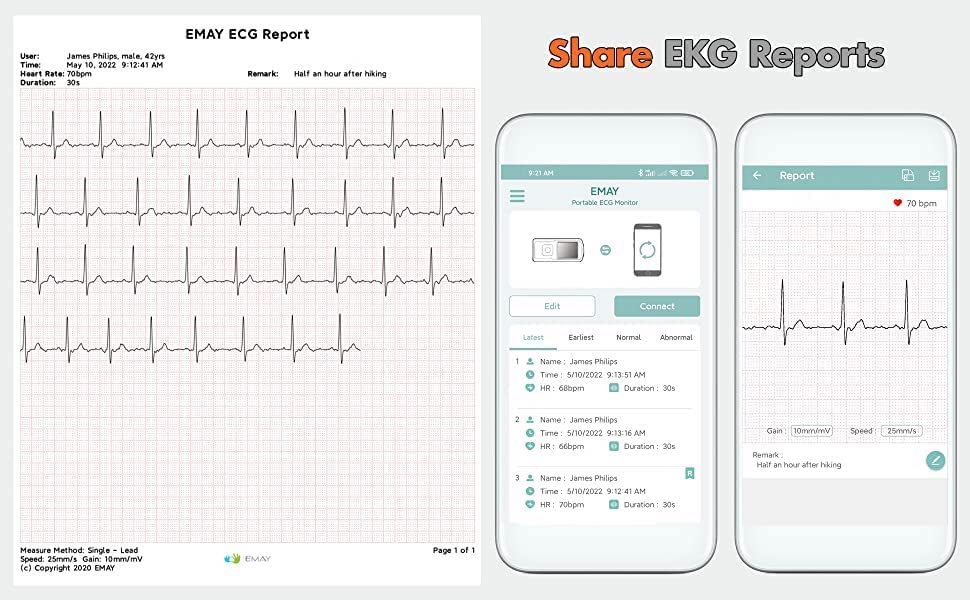 Emay Portable Ecg Monitor Dispositivos inalámbricos de monitoreo Ekg